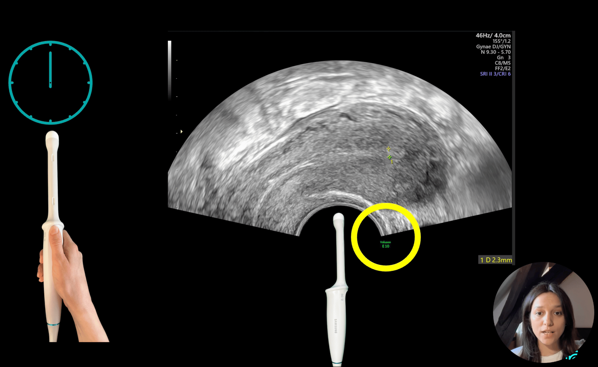 2025NOV19 Nina Cooper - intro to TVUS